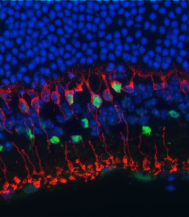 Degenerated cones in cultured human retina